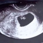 iskustva-trudnoca1.1-150x150