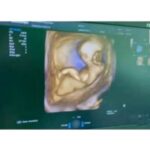 iskustva-trudnoca2-150x150